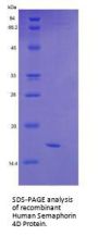 Human Semaphorin 4D (SEMA4D) Protein
