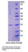 Human Chorionic Gonadotropin Beta Chain (CGB) Protein