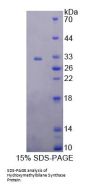 Human Hydroxymethylbilane Synthase (HMBS) Protein