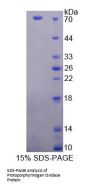 Human Protoporphyrinogen Oxidase (PPOX) Protein