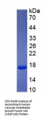 Human Vascular Endothelial Growth Factor 145 (VEGF145) Protein