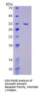 Human Discoidin Domain Receptor Family, Member 1 (DDR1) Protein