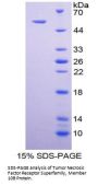 Human Tumor Necrosis Factor Receptor Superfamily Member 10B / DR5 (TNFRSF10B) Protein
