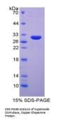 Human Superoxide Dismutase Copper Chaperone (CCS) Protein