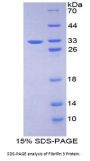 Human Fibrillin 3 (FBN3) Protein