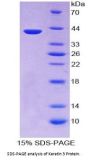 Human Keratin 3 (KRT3) Protein