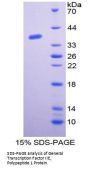Human General Transcription Factor IIE, Polypeptide 1 (GTF2E1) Protein