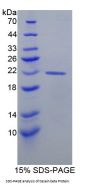 Human Beta-Casein (CSN2) Protein