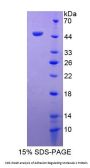 Human Adhesion Regulating Molecule 1 (ADRM1) Protein