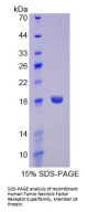 Human Tumor Necrosis Factor Receptor Superfamily, Member 19 (TNFRSF19) Protein