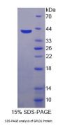 Human Glycosylphosphatidylinositol Specific Phospholipase D1 (GPLD1) Protein