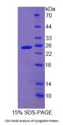 Human Cytoglobin (CYGB) Protein