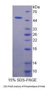 Human Phospholipase B (PLB1) Protein