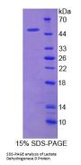 Human Lactate Dehydrogenase D (LDHD) Protein