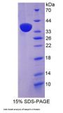 Human Nesprin 2 (SYNE2) Protein