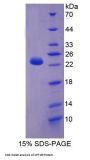 Human Carnitine Palmitoyltransferase 1B, Muscle (CPT1B) Protein