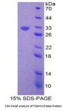 Human Filamin B Beta (FLNb) Protein