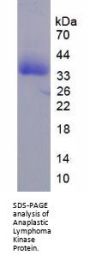 Human ALK Tyrosine Kinase Receptor (ALK) Protein