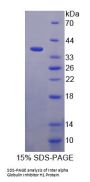 Human Inter Alpha-Globulin Inhibitor H1 (ITIH1) Protein