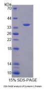 Human Syntenin 1 (ST1) Protein