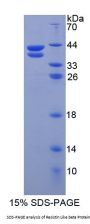 Human Resistin Like Beta (RETNLb) Protein