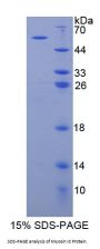 Human Myosin IC (MYO1C) Protein
