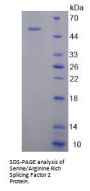 Human Serine/Arginine Rich Splicing Factor 2 (SRSF2) Protein