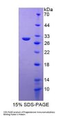 Human Progesterone Immunomodulatory Binding Factor 1 (PIBF1) Protein