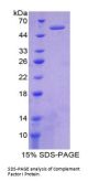 Human Complement Factor I (CFI) Protein