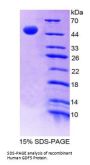 Human Growth Differentiation Factor 5 (GDF5) Protein