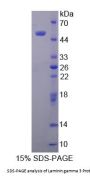Human Laminin Gamma 3 (LAMC3) Protein