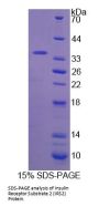 Human Insulin Receptor Substrate 2 (IRS2) Protein