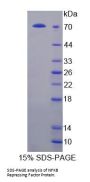 Human NFKB Repressing Factor (NKRF) Protein