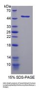 Human Lysophosphatidylcholine Acyltransferase 1 (LPCAT1) Protein