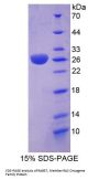 Human RAB37, Member RAS Oncogene Family (RAB37) Protein