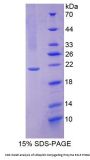 Human Ubiquitin Conjugating Enzyme E2L3 (UBE2L3) Protein