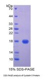 Human Cystatin 5 (CST5) Protein