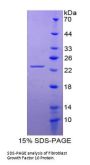 Human Fibroblast Growth Factor 10 (FGF10) Protein