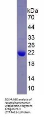 Human Cytokeratin 19 Fragment Antigen 21-1 (CYFRA21-1) Protein