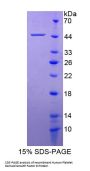 Human Platelet Derived Growth Factor D (PDGFD) Protein