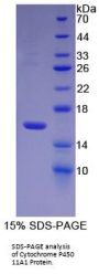 Human Cytochrome P450 11A1 (CYP11A1) Protein