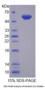 Human Annexin A11 (ANXA11) Protein