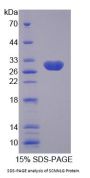Human Amiloride Sensitive Sodium Channel Subunit Gamma (SCNN1g) Protein
