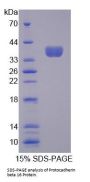 Human Protocadherin Beta 16 (PCDHb16) Protein