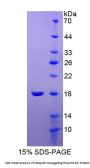 Human Ubiquitin Conjugating Enzyme E2I (UBE2I) Protein
