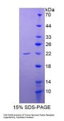 Human TNF Receptor Superfamily Member 5 / TNFRSF5 (CD40) Protein