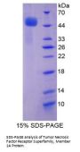 Human Tumor Necrosis Factor Receptor Superfamily Member 1A / CD120a (TNFRSF1A) Protein