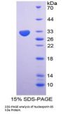 Human Nucleoporin 85 kDa (NUP85) Protein
