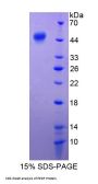 Human Pigment Epithelium-Derived Factor / PEDF (SERPINF1) Protein