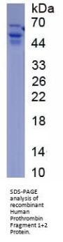 Human Prothrombin Fragment 1+2 (F1+2) Protein